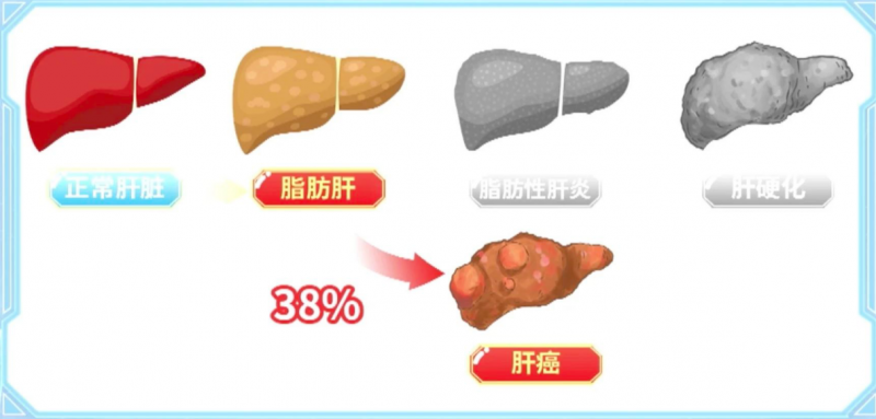 肝癌风险可逆转？LAIFE「乐轻肝」揭秘预防之道！