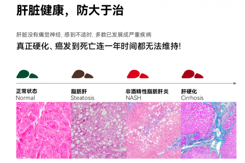 《柳叶刀》：肝脏受损引发多项慢性疾病，乐轻肝释放肝脏压力